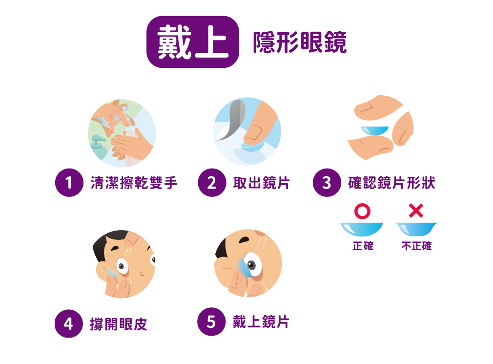 上明眼科近視管理計畫-Misight