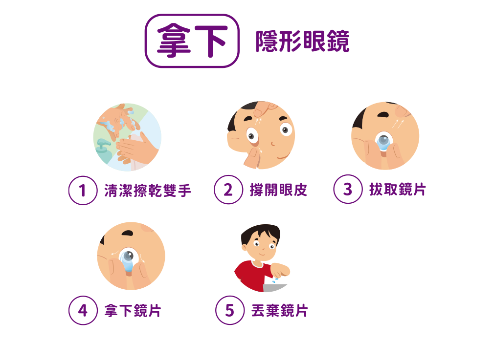 上明眼科近視管理計畫-Misight