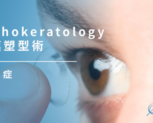 近視控制｜Orthokeratology 角膜塑型術