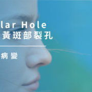 黃斑部病變｜Macular Hole 原發性黃斑部裂孔