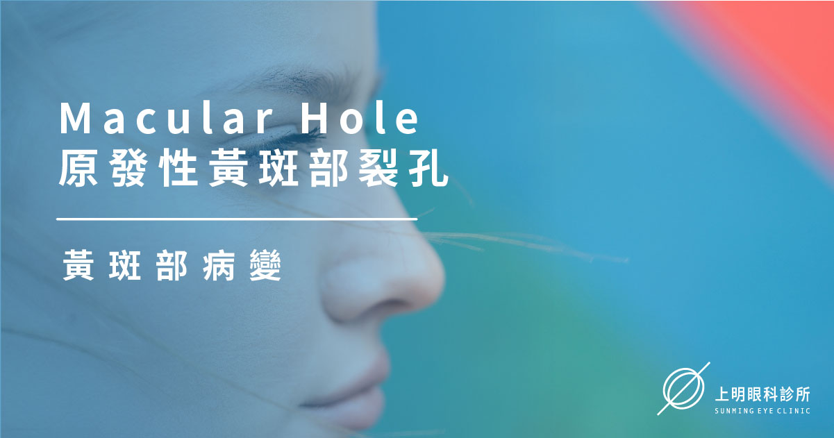 黃斑部病變｜Macular Hole 原發性黃斑部裂孔