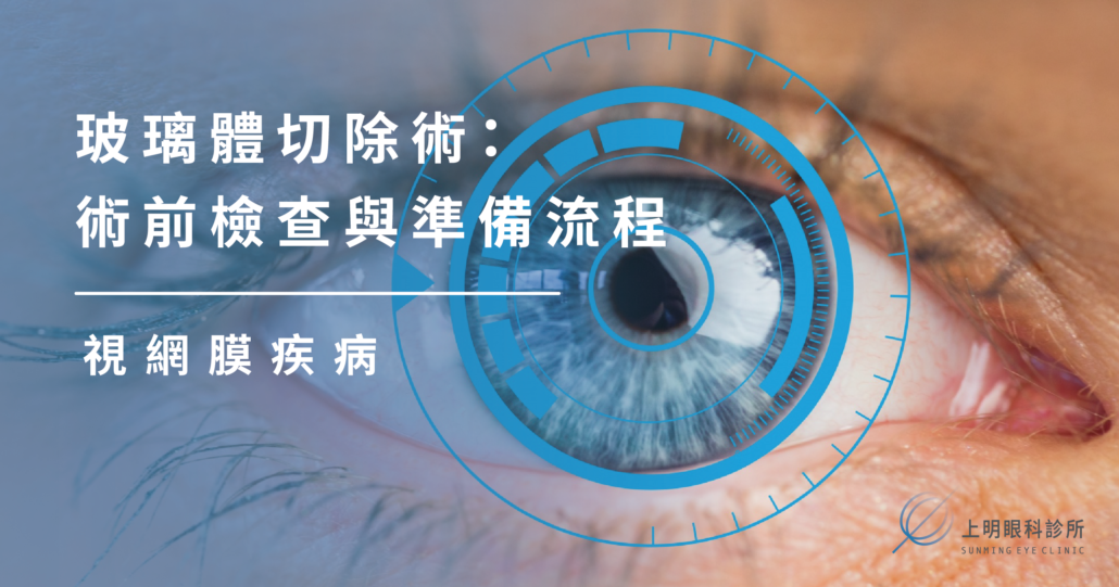 視網膜疾病|玻璃體切除術:術前檢查與準備流程 - 上明眼科