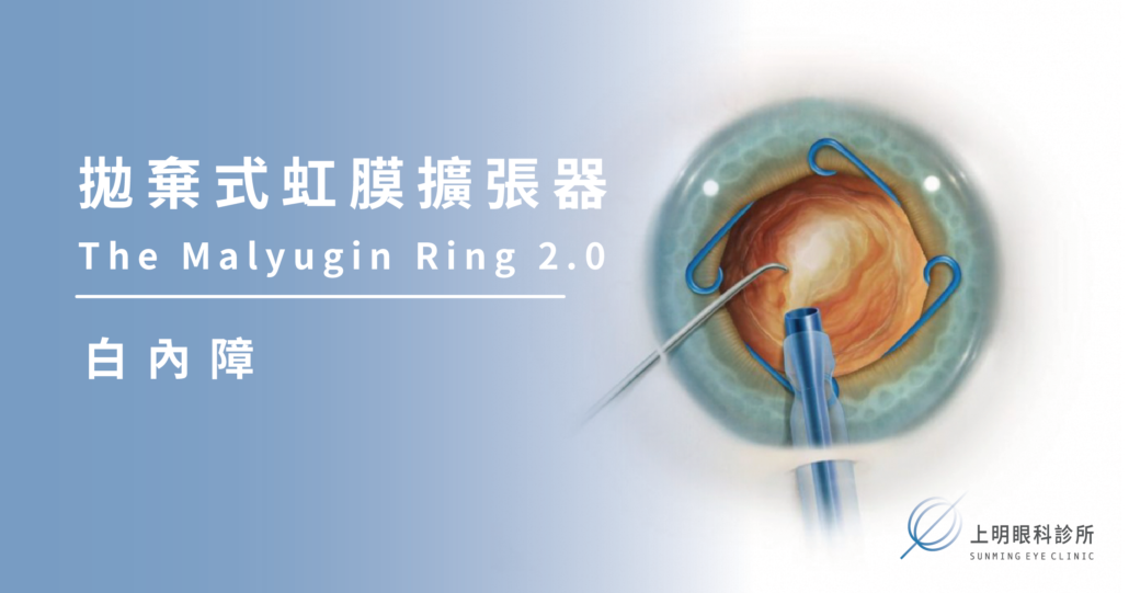 上明眼科-白內障-拋棄式虹膜擴張器The Malyugin Ring 2.0