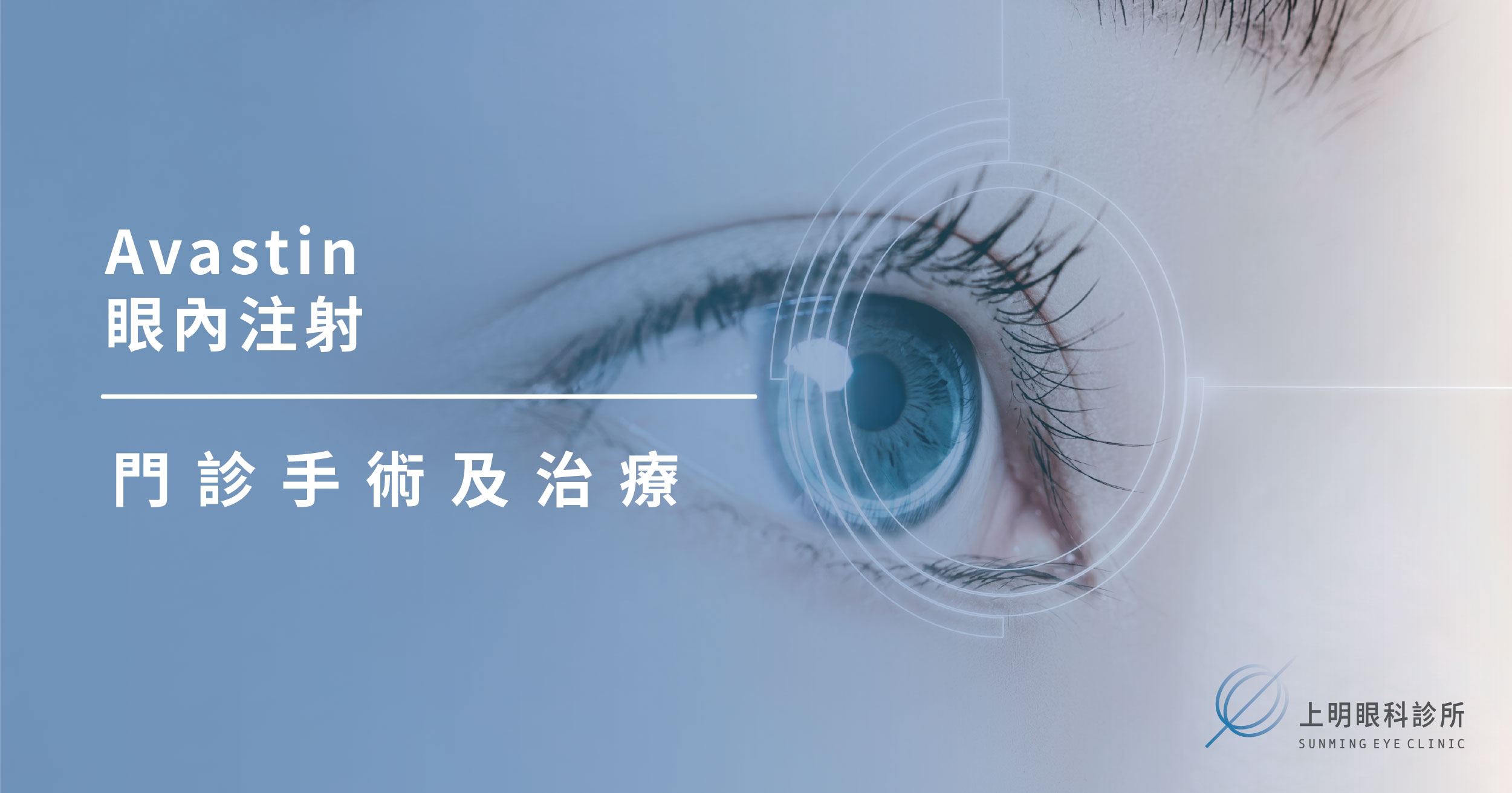 上明眼科-儀器設備介紹-Avastin