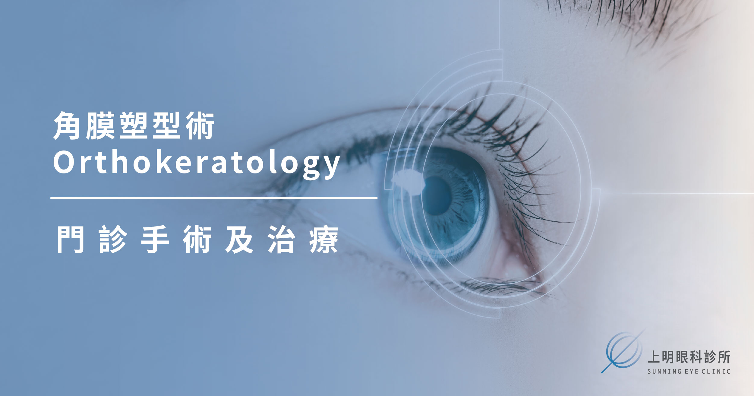 上明眼科-儀器設備介紹-角膜塑型術 Orthokeratology