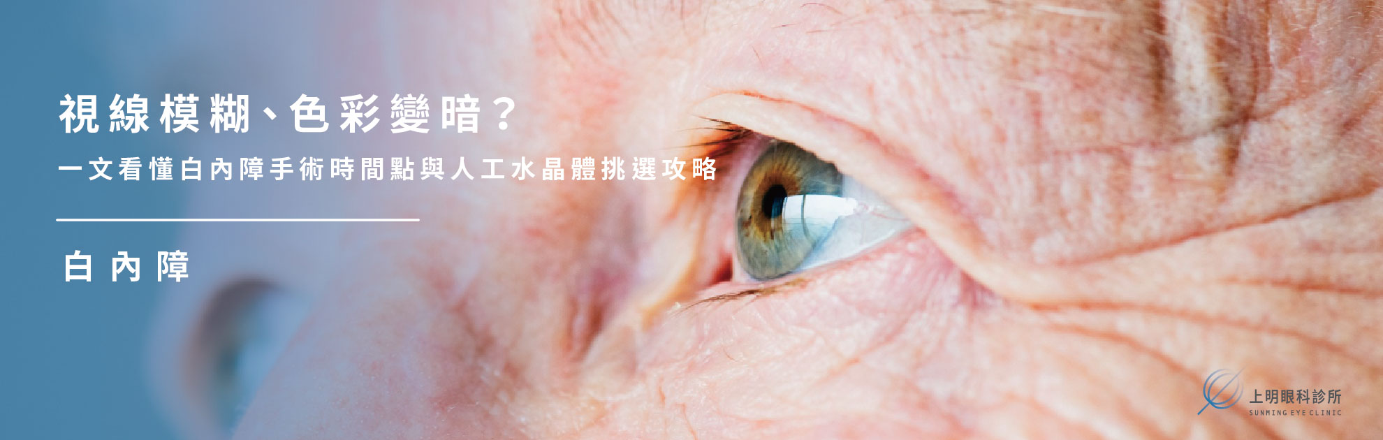 白內障手術時間點怎麼選？人工水晶體挑選指南與費用建議