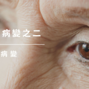 老年性黃斑部病變AMD-2