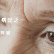 老年性黃斑部病變AMD-1