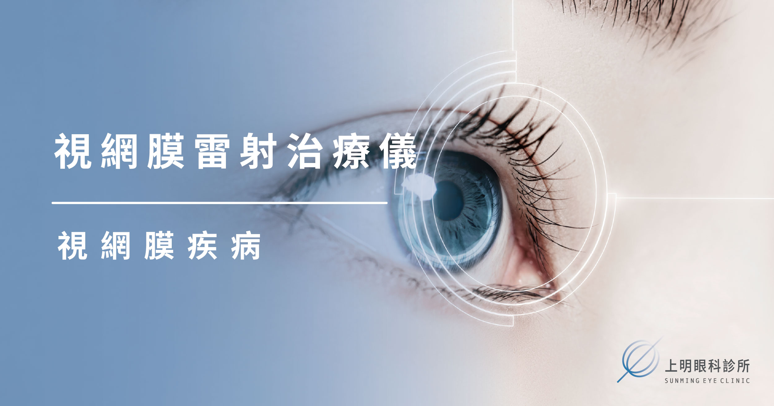 視網膜雷射治療儀