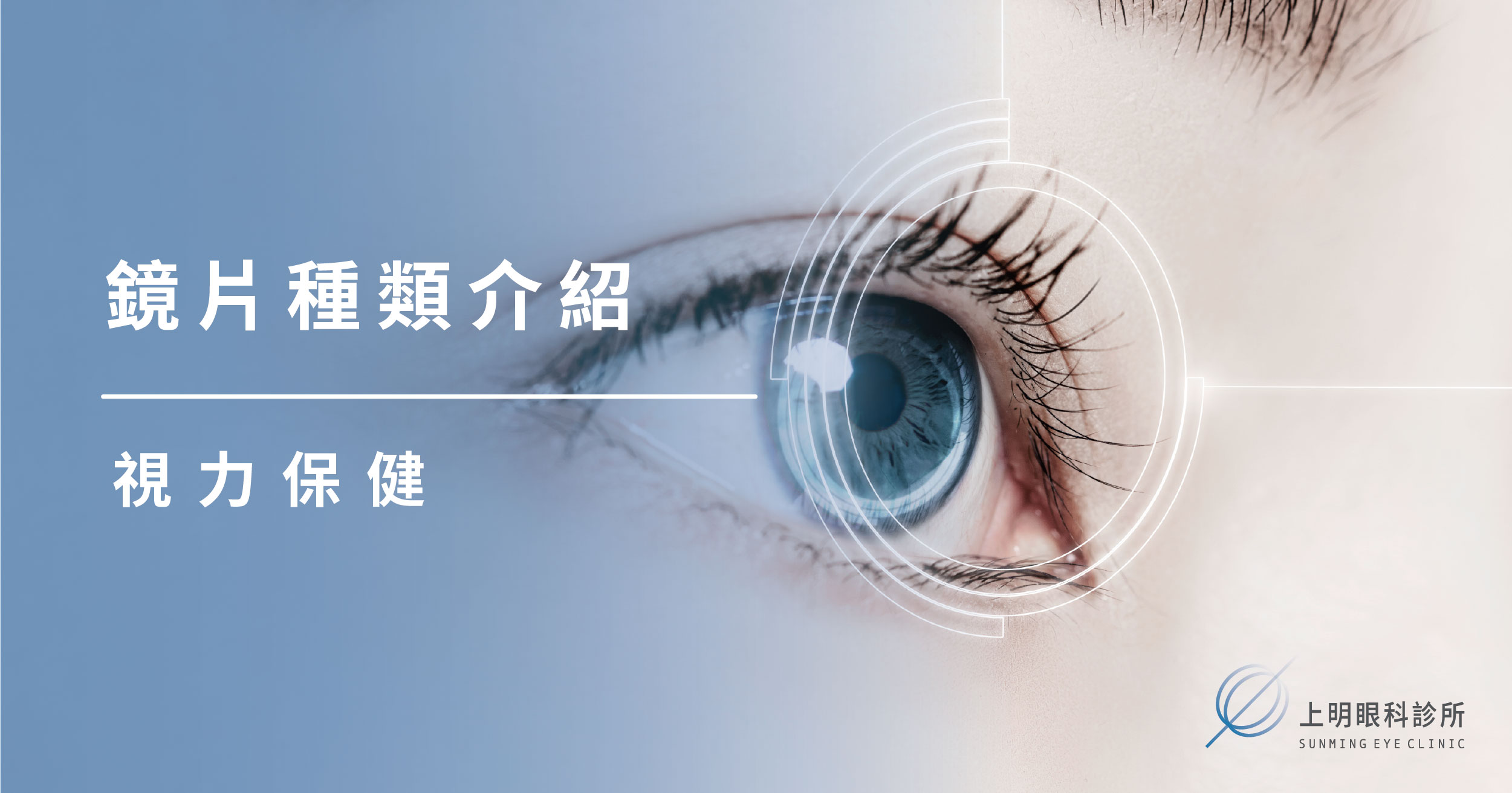 上明眼科-鏡片種類介紹