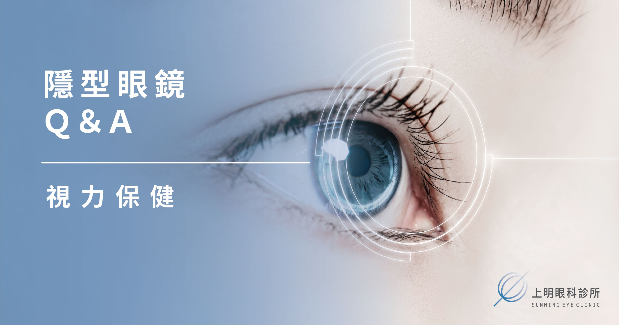 上明眼科-隱型眼鏡Q&A